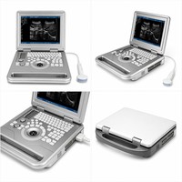 Ultrasonido Veterinary Portatil B/N Laptop Black White Veterinary Ultrasound Machine Scanner Ecografo Para Perros Gatos