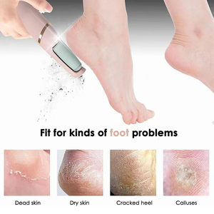 Appareil de Soin des Pieds Rechargeable pour Enlever les Callosités et Peaux Mortes – Vente en Gros d'Appareils Ménagers Maternels et Infantiles - Product Image 6