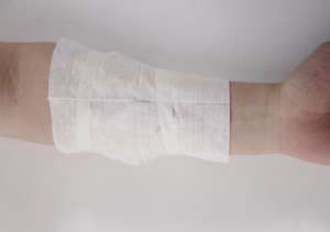 อุปกรณ์ปิดแผลฟิล์ม <span class=keywords><strong>PET</strong></span> แบบใช้แล้วทิ้งอุปกรณ์ป้องกันแผลที่ผิวหนัง - Product Image 6