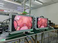 Caméra d'endoscopie médicale OEM Camjoy 27 pouces pour usage chirurgical et clinique