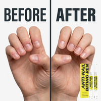 Stylo anti-mastication des ongles à marque privée, au denatonium benzoate, goût amer, pour enfants et adultes, réparation des cuticules