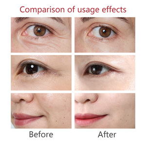 Siero Anti-Età Matrixyl 3000 per Riduzione Rughe, Rassodamento, Rimpolpamento e Riparazione della Pelle con Texture Acquosa ad Assorbimento Rapido - Product Image 5
