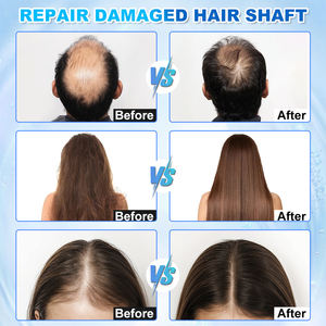 Análisis contrastivo antes y después 50X 200X HD Detector Cuidado del cabello Masajeador de cabeza 5 en 1 Máquina analizadora de cuero cabelludo - Product Image 6