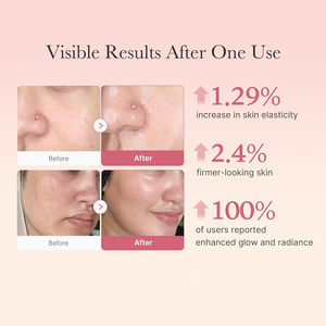 Huidwhitening Gezichtscrème Met Vitamine C Gezicht Whitening Crème Verheldering Organische Anti Rimpel Hydraterende Gezichtscrèm - Product Image 5