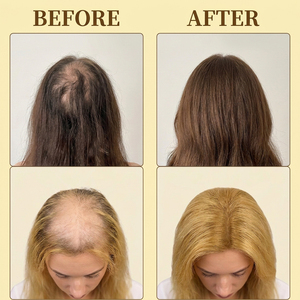 Poudre capillaire SIFEE aux herbes pour combler les zones clairsemées, couvrance instantanée, contrôle du sébum, couvre les cheveux gris et blancs, application facile - Product Image 5