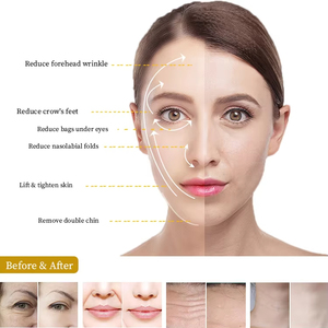 Mặt và cơ thể làm giảm mạnh mẽ thiết bị nếp nhăn thang máy chảy xệ da cho tăng cường jawline định nghĩa - Product Image 4