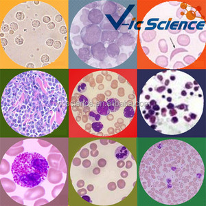 Disturbances in Human Blood Circulation Pathological <strong>Microscope</strong> Prepared Slides Histology Medical Science Prepared Slides - Product Image 1