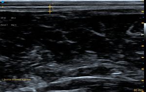 <strong>Veterinarian</strong> Compacto Y Resistente IPX7 Ecografo Portatil Para Diagnostic Bovina En Granja - Product Image 4