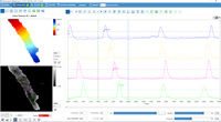 Sistema de Mapeo de Calcio y Contracción para Aplicaciones de Análisis de Movimiento y Transitorios de Calcio en Cardiomioscitos in Vitro