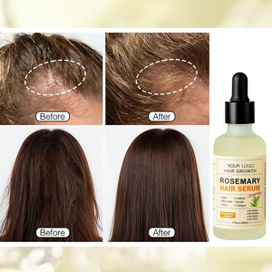 <span class=keywords><strong>เซ</strong></span><span class=keywords><strong>รั่</strong></span><span class=keywords><strong>ม</strong></span>บำรุงผ<span class=keywords><strong>ม</strong></span>โรสแ<span class=keywords><strong>ม</strong></span>รี่ แบรนด์ส่วนตัว สำหรับผมแห้ง รังแค บำรุงรากผม ซ่อมแซ<span class=keywords><strong>ม</strong></span>ผมแตกปลาย สำหรับผู้หญิงและผู้ชาย รับผลิตแบบ OEM ขายส่ง - Product Image 6