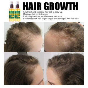 <span class=keywords><strong>Spray</strong></span> anti-chute de <span class=keywords><strong>cheveux</strong></span> à la gingembre biologique Luxfume, marque privée, nourrissant et stimulant la <span class=keywords><strong>repousse</strong></span> des <span class=keywords><strong>cheveux</strong></span> - Product Image 6