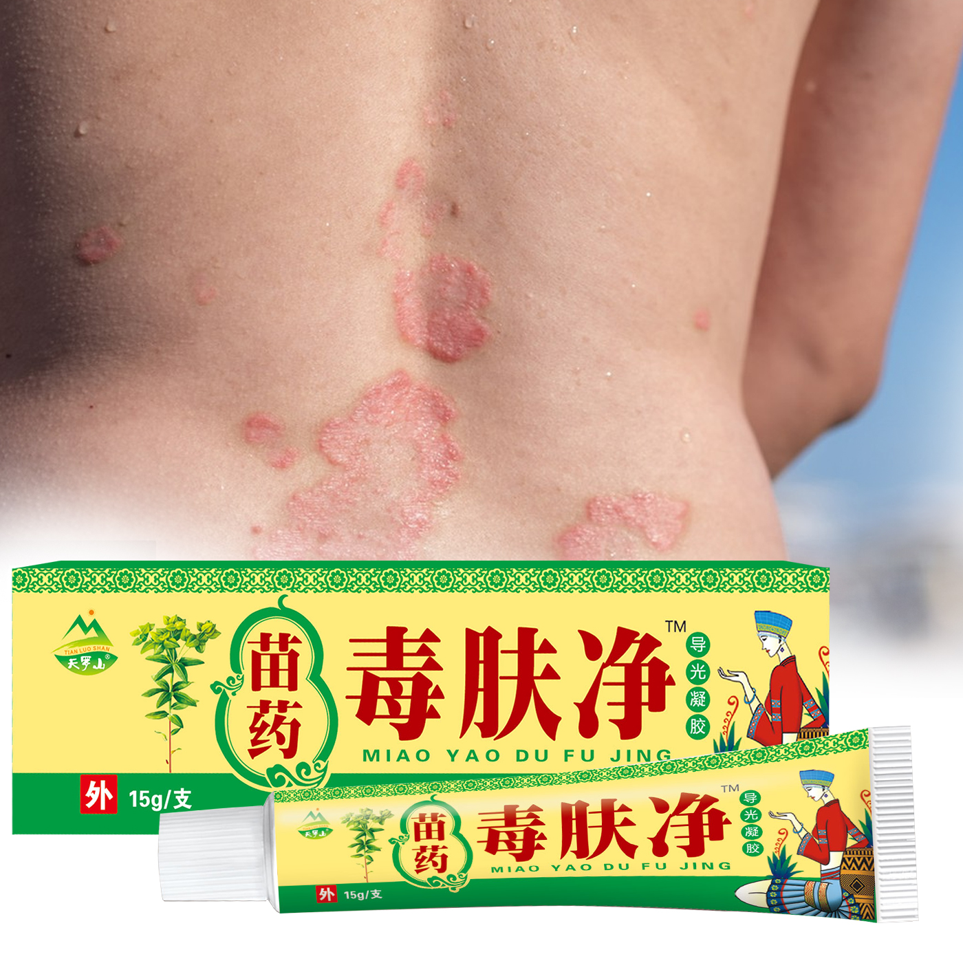 Huore branded external Chinese herbal medicine supports customized antipruritic eczema cream dermatophyte gel
