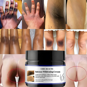 Crema Humectante Blanqueadora con Niacinamida de Acción Rápida en 7 Días para Zonas Íntimas y Áreas Oscuras (Rodillas, Nudillos, Codos, Axilas) - Product Image 1