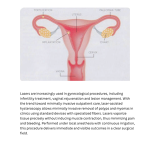 Dispositivo de Lipólisis Endolifting LVR de 1470nm y 980nm para Uso en Clínicas Estéticas - Product Image 5