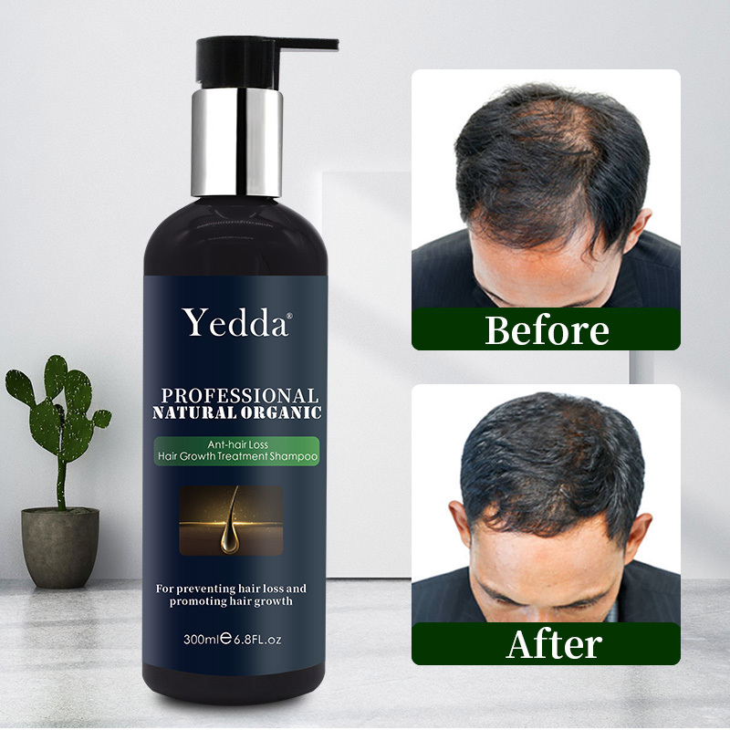 100 Natural Organic Hair Serum OEM