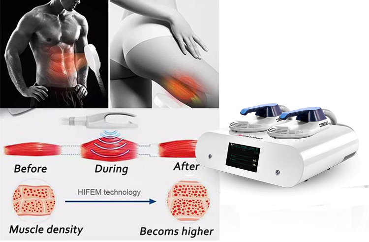 EMS Cellulite Reduction Training Equipment EMShif Fat Burn Muscle Stimulator for Slimming