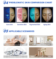 Analizador Facial de Piel 3D con Pantalla de 15.6 Pulgadas, Dispositivo de Escritorio con Multi-Análisis (Pigmentación, Arrugas, Acné) para Uso Doméstico y Comercial