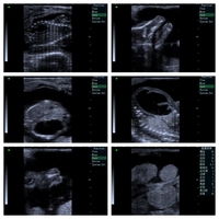 Machine à ultrasons diagnostique vétérinaire entièrement numérique portable pour équins pour usage général et soins aux animaux portables