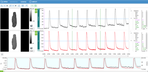 Mendeteksi Potensi Aksi dan Sinyal Transien Kalsium dalam Model Jantung Mini dan Organoid - Product Image 3