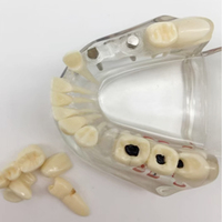Étude orthodontique standard dentiste restauration anatomique implant dentaire modèle de prothèse dentaire