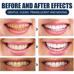 Disposable Wipe Oral Finger Brush Up Disposable Finger Toothbrush Adult <b>Teeth</b> Whitening Strips Gentle <b>Teeth</b> <b>Cleaning</b> <b>Tools</b> - Product Image 2