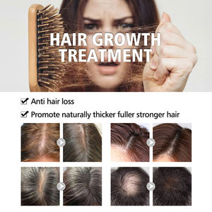 Aangepaste Natuurlijke Anti Verlies Organische Veganistische Castor Haargroei Olieproducten Biotine Rozemarijn Mint Haar Shampoo En Conditioner - Product Image 6