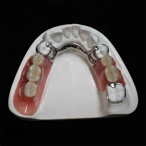 Marco de metal completo de mandíbulas <span class=keywords><strong>superior</strong></span> e inferior con <span class=keywords><strong>dentadura</strong></span> acrílica <span class=keywords><strong>parcial</strong></span> Precios súper bajos - Product Image 2