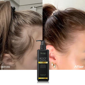 Private Label Organic Nourishing Scalp Root Activating Strengthening <b>Shampoo</b> for <b>Hair</b> Growth & Repair - Product Image 6