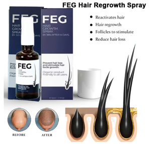 Eternal <span class=keywords><strong>Elinor</strong></span> - El Mejor Suero Orgánico Anticaída y para el Crecimiento del Cabello, 60 ml * 3, Tratamiento de Crecimiento Rápido para Hombres con Calvicie, 100% Natural a Base de Hierbas - Product Image 5