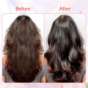 Huyết thanh tăng trưởng tóc nghệ-Kích hoạt nang & cai nghiện da đầu, không nhờn, hói đầu nam & nữ - Product Image 4