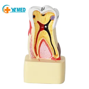 医学科学人体实用小牙蛀牙模型义齿解剖仿真建模实践演示教学