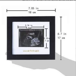 Marco de Fotos para Ecografía de Bebé, Recuerdo de Ultrasonido 'Amor a Primera Vista', Regalo para Recién Nacido con Tarjeta de Bienvenida, OEM - Product Image 2
