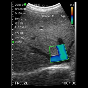 128 तत्व वायरलेस उत्तल सरणी जांच 3.5mhz 5mhz वाईफ़ाई रंग डोप्लर cf pw और pdi फ़ंक्शन - Product Image 5