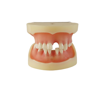 Modelo de Práctica de <span class=keywords><strong>Implantes</strong></span> <span class=keywords><strong>Dentales</strong></span> para Prótesis Totales, Modelo de Enseñanza de Prótesis Orales, Modelo Anatómico de <span class=keywords><strong>Implantes</strong></span> <span class=keywords><strong>Dentales</strong></span> - Product Image 3