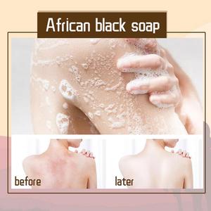 100% savon noir africain magique Anti Taches <span class=keywords><strong>rebelles</strong></span> beauté bain corps acné peau savon soins du corps 110g - Product Image 4