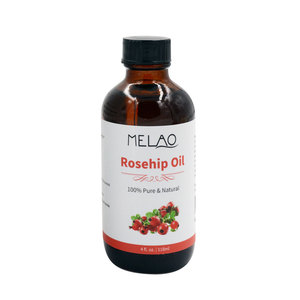 100% puro prensado en frío y virgen orgánico aceite de semilla de <span class=keywords><strong>rosa</strong></span> mosqueta para <span class=keywords><strong>la</strong></span> cara y de <span class=keywords><strong>la</strong></span> piel - Product Image 1