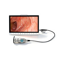 Système de caméra endoscopique portable 13,3 pouces 1080P avec enregistreur pour laparoscopie et arthroscopie