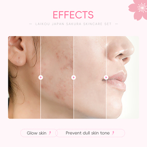 Kit de soin du visage professionnel LAIKOU Sakura 8 pièces, vitamine C, niacinamide pour hydrater, réparer et lutter contre le vieillissement de la peau - Product Image 3