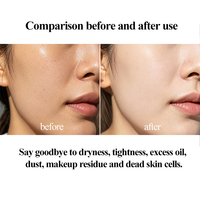 Nettoyant Visage à la Rose Personnalisable, Soin Quotidien Tout-en-Un, Élimine l'Excès de Sébum, le Maquillage et les Impuretés, Répare la Barrière Cutanée