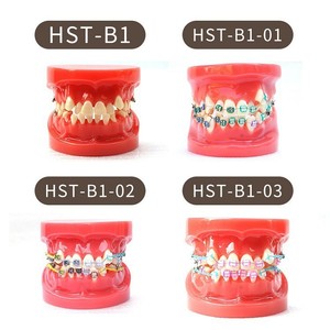 Modelo de Ortodoncia Dental Serie HST B6 con Aparatos para Práctica y Enseñanza - Product Image 4