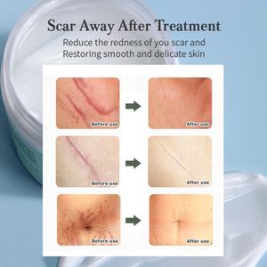 Crema Herbal para Eliminar Cicatrices y Reparar la Piel, Antiinflamatoria, para el Cuidado Diario, 100g, para Todo Tipo de Piel, Venta al Por Mayor - Product Image 6