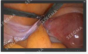 จอแสดงผลสำหรับการผ่าตัดแบบส่องกล้องคุณภาพสูง ขนาด 27 นิ้ว 32 นิ้ว 55 นิ้ว สำหรับใช้ในโรงพยาบาล เครื่องมือไฟฟ้า - Product Image 4