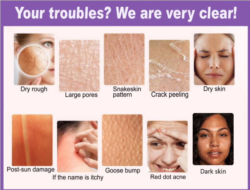 Частная этикетка, 500 мл, большой размер, гиалуроновая кислота, удаляет пятна от акне, niacinamide, увлажняющий отбеливающий лосьон для тела