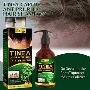 Shampoo capillaire antiprurigineux South Moon Tinea Capitis, antipelliculaire et antiprurigineux, à base d'acides aminés, pour des cheveux lisses, shampooing en marque privée - Product Image 3