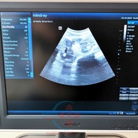 Ecógrafo Doppler Color Mindray DC-28 Usado, Máquina de Ultrasonido Portátil