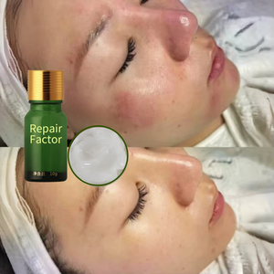 Crema Reparadora de Barrera Facial con EGF de Fábrica OEM, Crema Hidratante Calmante para Piel Dañada, Reparación de Cicatrices, Productos Calmantes con EGF - Product Image 1