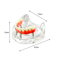 YOUYA DENTAL Nuevo Modelo de Implante Dental de Resina MX-089, 4 Implantes, Mandíbula Baja, Puente Maryland, Restauración de Sobredentadura, Tipodonto Educativo