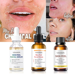 Nhật Bản Bình Thường Vitamin <span class=keywords><strong>C</strong></span> Chăm Só<span class=keywords><strong>c</strong></span> Da Huyết Thanh Giảm Mụn Trứng <span class=keywords><strong>C</strong></span>á Đốm Đen Mặt Ampule Hàn Quố<span class=keywords><strong>c</strong></span> Giữ Ẩm Vàng Hữu <span class=keywords><strong>C</strong></span>ơ Sáng - Product Image 3