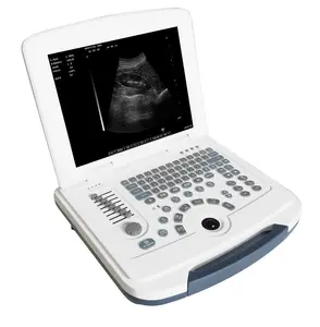 Chariot portable Scanner à ultrasons noir et blanc DAWEI DW-580 à ultrasons