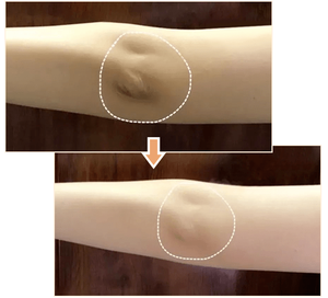 Peeling-Öl für Knöchel Serum Flüssigkeit Strong White ning Body Serum Öl Starkes Peeling-Öl - Product Image 5